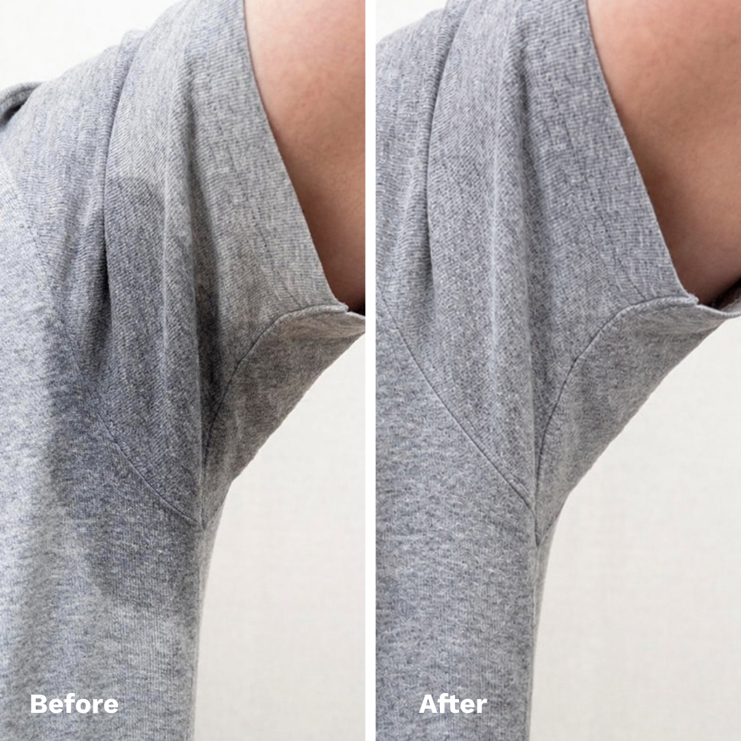 Sweat-Stopping Armpit Roller